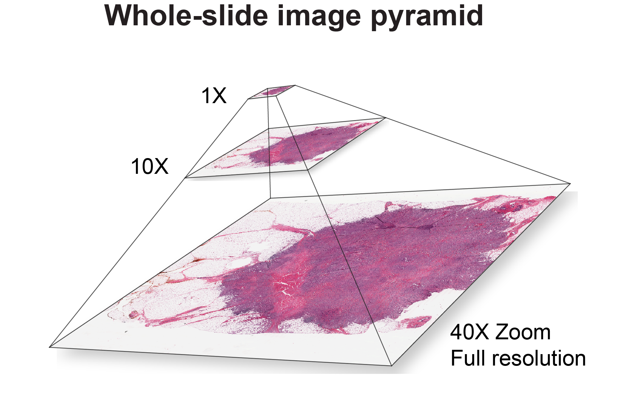 Whole-slide image pyramid illustrating multi-resolution access from downscaled to full-resolution tissue.
